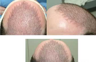 Centro de Implante Capilar - Foto 1