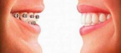 plano-odontologico-fortaleza-1358538929