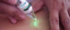 terapia-fortaleza-1358540619
